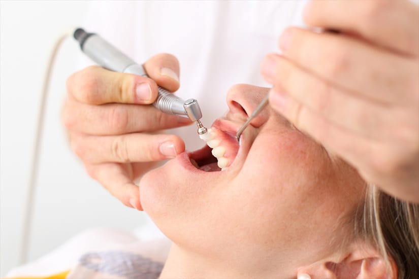Scaling & Polishing Ardmore Dental Clinic