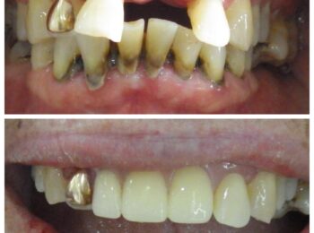 Ardmore Dental we change smiles