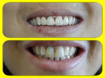 Ardmore Dental we change smiles