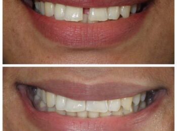 Ardmore Dental we change smiles