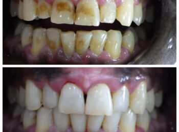 ardmore dental 4